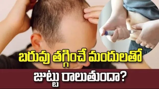 బరువు తగ్గించే మందులతో జుట్టు రాలుతుందా? తాజా అధ్యయనంలో కీలక విషయాలు